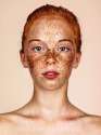 Freckle Model.jpg