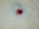 bullet wound.jpg