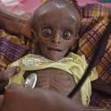 kenya-poor-malnourished-child-e1324923127861.jpg