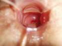 cervix-and-more-019-1-1024x768.jpg
