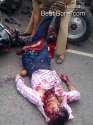 accident-leaves-man-ripped-open-leg-kashmir-india-01-840x1120.jpg