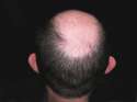baldhead.jpg