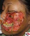 Woman_face_disease.jpg