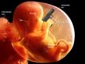 fetus-with-gun.jpg