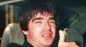 Noel-Gallagher-Oasis-teeth-before_940x526.jpg