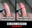 circumcize2.jpg