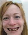 woman bad teeth.jpg