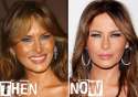 melania-trump-before-and-after.jpg