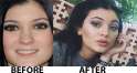 Kylie-Jenner-before-after-2.jpg