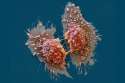 c0290303-cancer_cells_sem-spl-1200x800.png