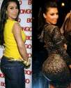 Kim-Kardashian-buttox-augmentation-Surgery-Before-and-After-Photos.jpg
