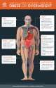 What-can-happen-in-your-body-when-youre-obese-or-overweight-infographic-rappler-20140723.jpg