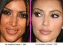 kim-kardashian-before-after.jpg