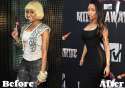 Nicki-Minaj-Plastic-Surgery-Before-and-After.jpg