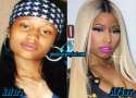 Nicki-Minaj-Nose-Job-Before-and-After.jpg
