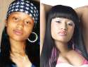 1093891_Nicki-Minaj-before-surgery-and-after_jpg16cc893e306878cfc7355daaf36daaf3.jpg