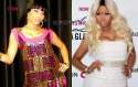 Nicki-Minaj-Plastic-Surgery-327.jpg