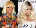 Nicki-Minaj-Boob-Job-Before-and-After.jpg