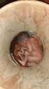 brazilian-woman-dies-during-late-term-abortion-her-home-01.jpg