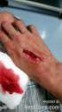 hand-trauma-shop-accidents-ontario-canada-01.jpg