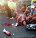 motorcycle-lose-leg-accident-costa-rica.jpg