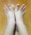 thumb toes.jpg