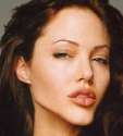 Angelina-Jolie-Jaw-Surgery--20611.jpg