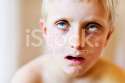 stock-photo-17974828-blond-boy-looks-vacant-special-needs-or-simply-pulling-faces.jpg
