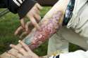 flesh-eating-heroin-knock-off-krokodil-appears-on-americas-east-coast-for-the-first-time-632x422.jpg