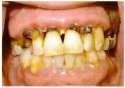 teeth2[1].jpg