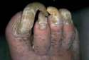 people-with-gross-nails-1.jpg