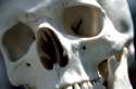 A-human-skull.jpg