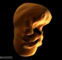 1343148096_bbc_one__human_face_development_in_the_womb__1_to_3_months.gif