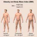 Obesity_&_BMI.png