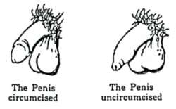 drawing-of-circumcised-penis-and-intact-or-uncircumcised-penis.gif