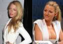 Blake-Lively-before-and-after-boob-job-surgery[1].jpg