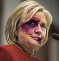 Hillary Bruised.jpg