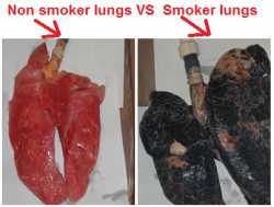 non smoker lungs vs smoker lungs.jpg