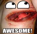 Awesomegore.jpg