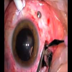 eye.webm