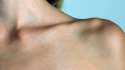 GTY_collar_bone_sk_150617_16x9_992.jpg