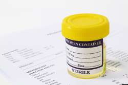 o-SUNCOR-DRUG-TEST-facebook.jpg