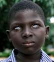 African Boy Blue Eyes.jpg