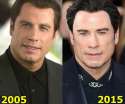 John-Travolta-Plastic-Surgery1.jpg