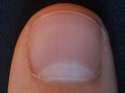 Nail(thumb)[1].jpg