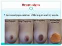 breast signs.jpg