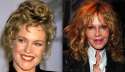 Melanie_Griffith-surgery-before-after.jpg
