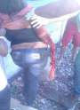 forum.goregrish.com.Girls arm nearly severed by train3.jpg