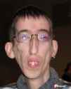 most-ugly-man-in-world-pics.jpg