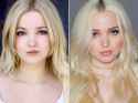 dove-cameron-before-and-after-1jpg.jpg